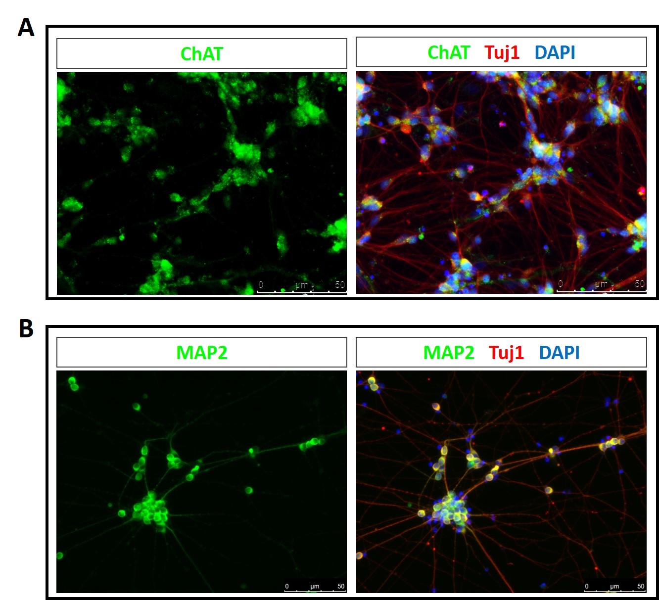 iPSC-derived motor neurons